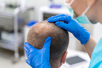 follicular unit strip surgerys